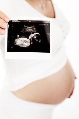 孕妇喝冰糖炖陈皮 治疗冬季咳嗽的好选择